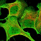 Immunofluorescent staining of human cell line U-2 OS shows localization to nucleoplasm & plasma membrane.