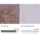 Anti-CR1 Antibody