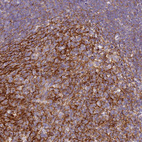 Anti-CR1 Antibody