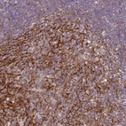 Immunohistochemical staining of human tonsil shows strong membranous positivity in germinal center cells.