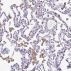 Immunohistochemical staining of human lung shows moderate cytoplasmic positivity in macrophages.