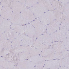 Immunohistochemical staining of human skeletal muscle shows no positivity in myocytes as expected.