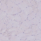 Anti-CR1 Antibody