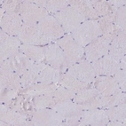 Immunohistochemical staining of human skeletal muscle shows no positivity in myocytes as expected.