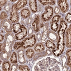 Anti-TICAM1 Antibody