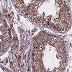 Immunohistochemical staining of human testis shows strong granular cytoplasmic positivity in cells in seminiferous ducts and leydig cells.