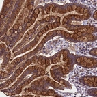 Immunohistochemical staining of human colon shows strong granular cytoplasmic positivity in glandular cells.