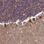 Immunohistochemical staining of human cerebellum shows 
strong granular cytoplasmic positivity in Purkinje cells.