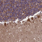 Immunohistochemical staining of human cerebellum shows 
strong granular cytoplasmic positivity in Purkinje cells.