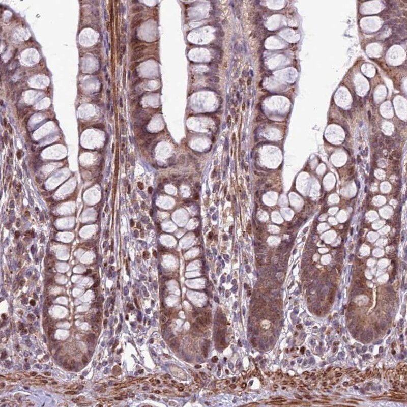Anti-HGH1 Antibody