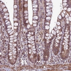 Anti-HGH1 Antibody