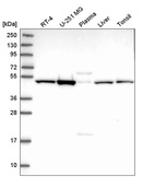 Western blot analysis in human cell line RT-4, human cell line U-251 MG, human plasma, human liver tissue and human tonsil tissue.