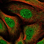 Immunofluorescent staining of human cell line U-2 OS shows localization to nucleoplasm, nuclear bodies & cytosol.