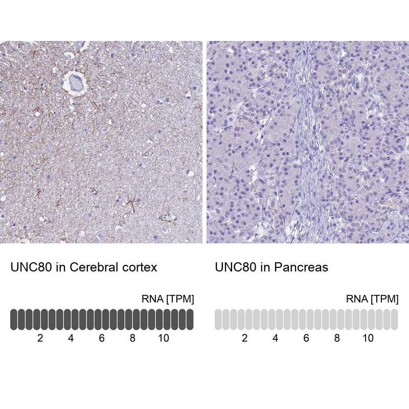Anti-UNC80 Antibody