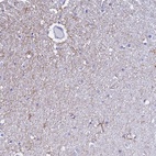 Immunohistochemical staining of human cerebral cortex shows high expression.