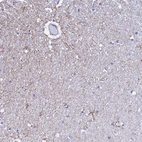 Immunohistochemical staining of human cerebral cortex shows high expression.