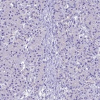 Anti-UNC80 Antibody