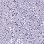 Immunohistochemical staining of human pancreas shows low expression as expected.