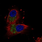 Anti-UNC80 Antibody