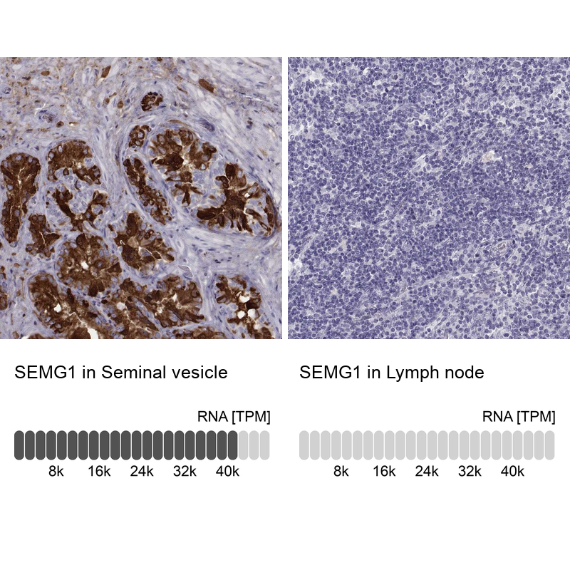 Anti-SEMG1 Antibody
