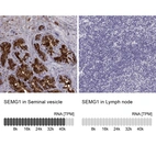 Anti-SEMG1 Antibody