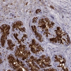 Immunohistochemical staining of human seminal vesicle shows high expression.