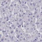Anti-SEMG1 Antibody