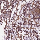 Anti-PRELID2 Antibody