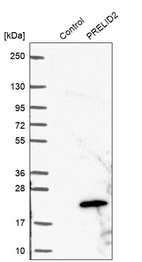 Western blot analysis in control (vector only transfected HEK293T lysate) and PRELID2 over-expression lysate (Co-expressed with a C-terminal myc-DDK tag (~3.1 kDa) in mammalian HEK293T cells, LY408585).
