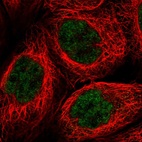 Immunofluorescent staining of human cell line A-431 shows localization to nucleoplasm.