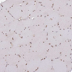Immunohistochemical staining of human skeletal muscle shows strong nuclear positivity in myocytes.