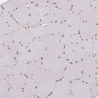 Immunohistochemical staining of human skeletal muscle shows strong nuclear positivity in myocytes.