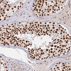 Immunohistochemical staining of human testis shows strong nuclear positivity in cells in seminiferous ducts.