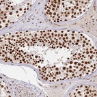Immunohistochemical staining of human testis shows strong nuclear positivity in cells in seminiferous ducts.
