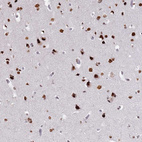 Immunohistochemical staining of human cerebral cortex shows strong nuclear positivity in neuronal cells.