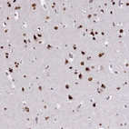 Immunohistochemical staining of human cerebral cortex shows strong nuclear positivity in neuronal cells.
