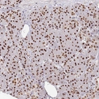 Immunohistochemical staining of human pancreas shows strong nuclear positivity in exocrine glandular cells.