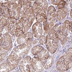 Anti-AGAP4 Antibody