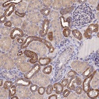 Anti-NIPSNAP3A Antibody