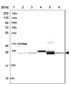 Lane 1: Marker [kDa] 250, 130, 95, 72, 55, 36, 28, 17, 10_br/_Lane 2: Human cell line RT-4_br/_Lane 3: Human cell line U-251 MG_br/_Lane 4: Human plasma_br/_Lane 5: Human Liver tissue_br/_Lane 6: Human Tonsil tissue