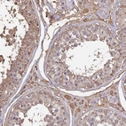 Anti-GLUD1 Antibody