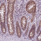 Anti-TTC9B Antibody