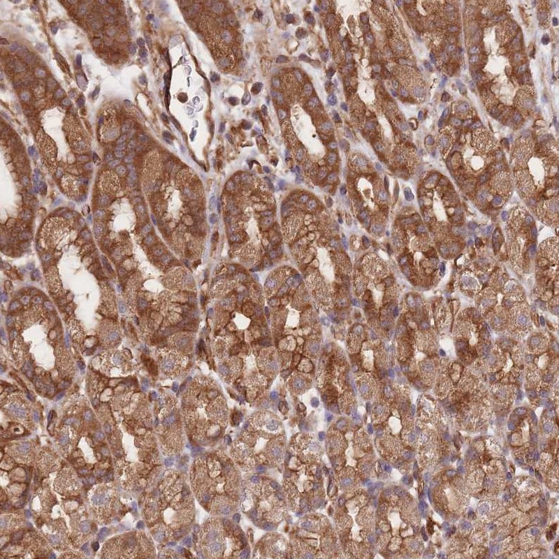 Anti-CCDC140 Antibody
