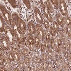 Anti-CCDC140 Antibody