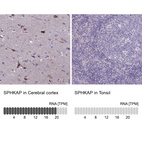 Anti-SPHKAP Antibody