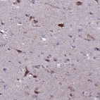Immunohistochemical staining of human cerebral cortex shows high expression.