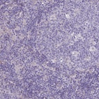 Anti-SPHKAP Antibody