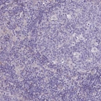 Immunohistochemical staining of human tonsil shows low expression as expected.