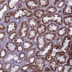 Anti-ICA1L Antibody