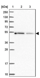 Lane 1: Marker [kDa] 250, 130, 95, 72, 55, 36, 28, 17, 10_br/_Lane 2: Human cell line RT-4_br/_Lane 3: Human cell line U-251MG sp